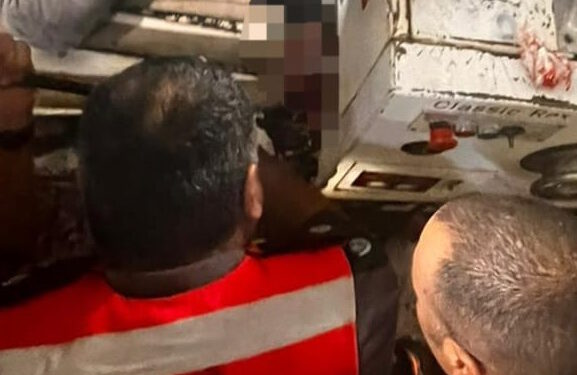 צעיר בן 20 מצפת נפצע בינוני כתוצאה מידו שנתפסה במכונת סופגניות